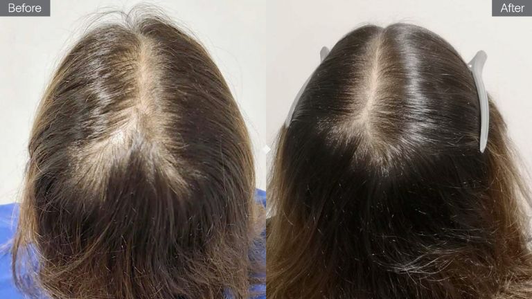 before and after hair treatment