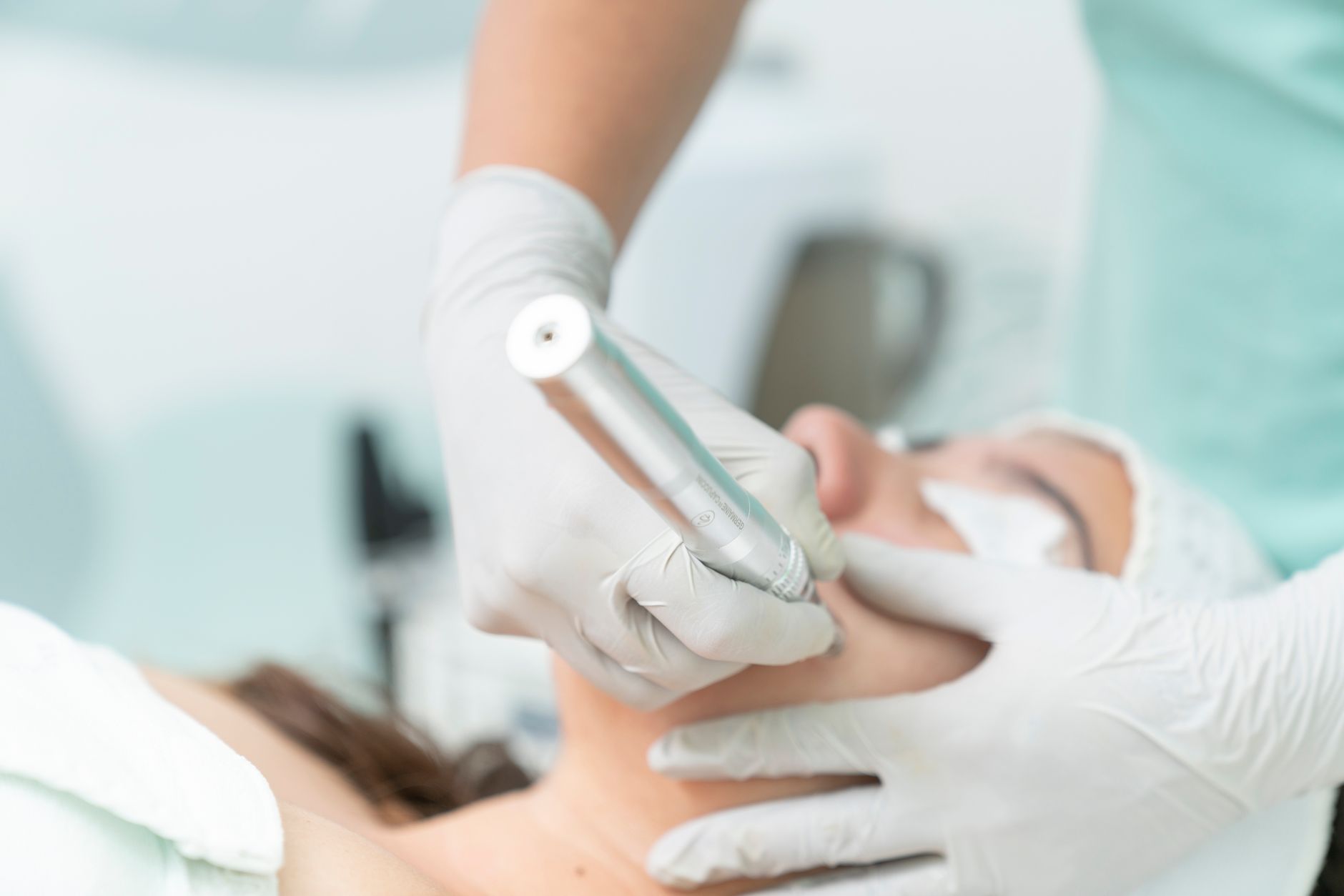 Close-up of a cosmetic microneedling treatment in a clinical setting